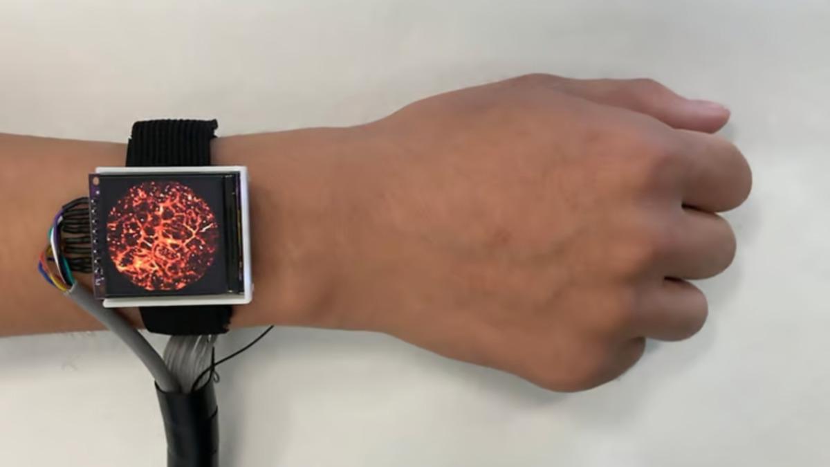 Damarlarınızdaki Kan Akışını Anlık Olarak Gösteren "Tıbbi Akıllı Saat" Geliştirildi