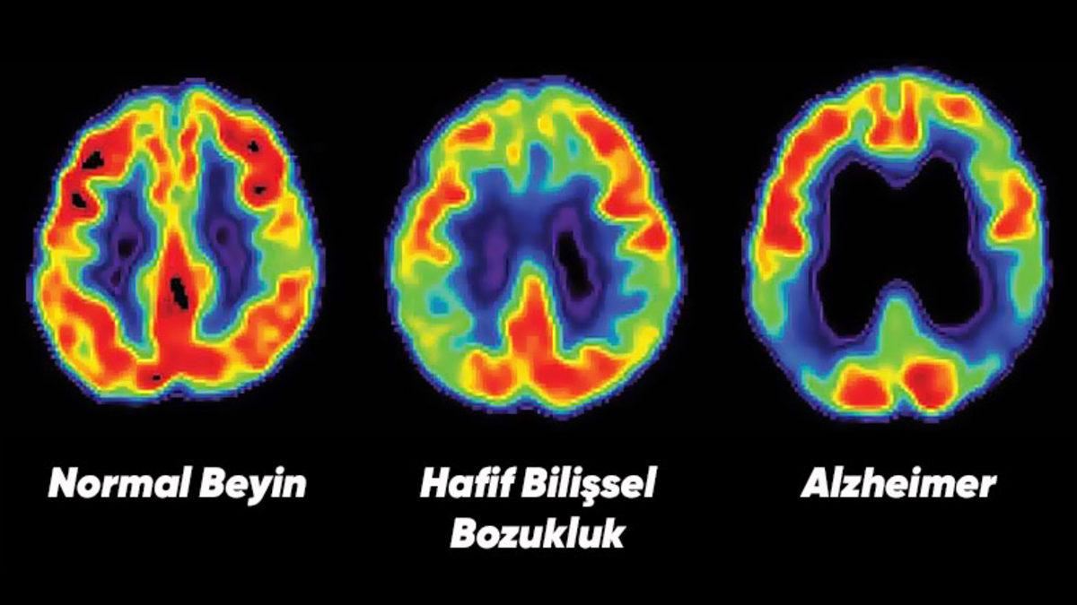 Zihninizi Sherlock Gibi Kullanmanızı Sağlayacak Ezber ve Hatırlama Metodu: Hafıza Sarayı
