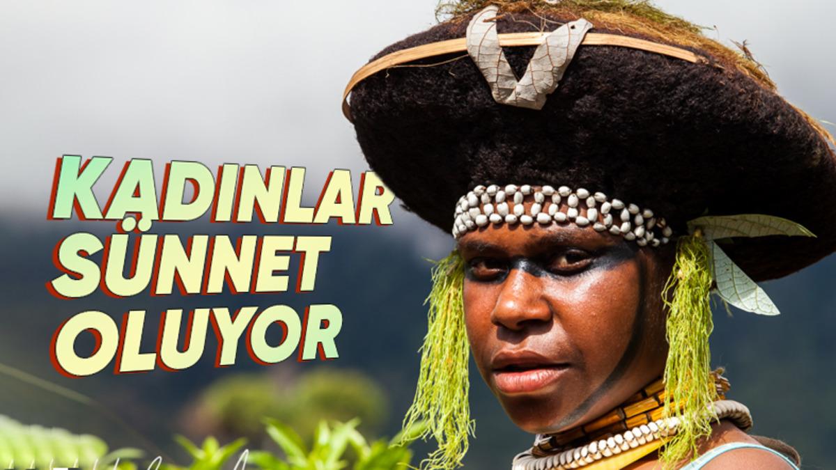 Dünya Rezervlerinin Neredeyse Yarısına Sahipken Nasıl Oldu da Bu Kadar Fakir Bir Ülke Hâline Geldi? Gine Hakkında 11 İlginç Gerçek