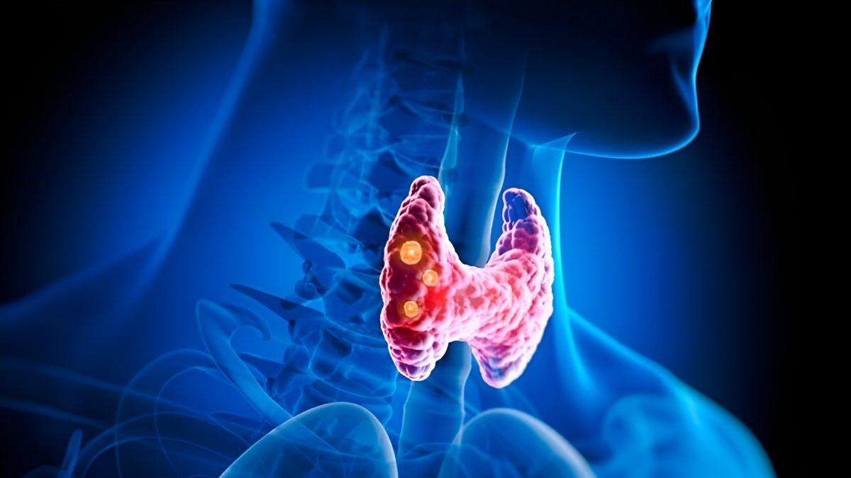 Sofra Tuzu Paketlerinde Neden Özellikle 