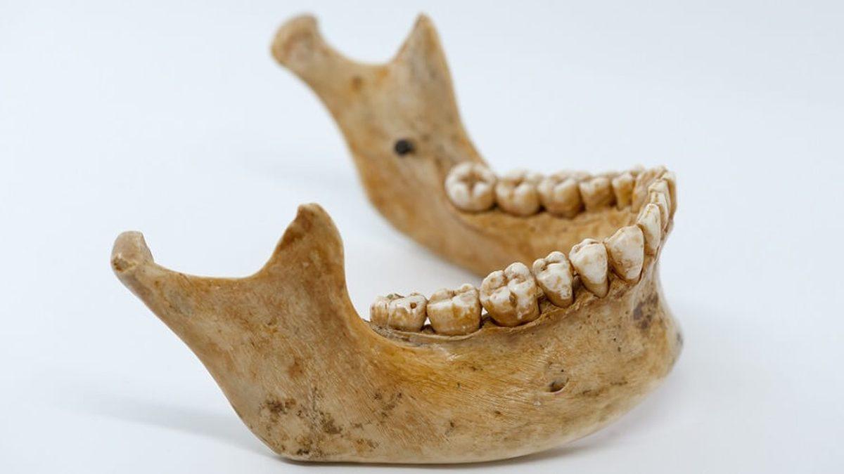 Çene Ucunun, Koskoca Hayvanlar Aleminde Sadece İnsanlarda Olmasının Sebebi Ne? Cinsel Seçilim Bile Rol Oynuyor Olabilir!