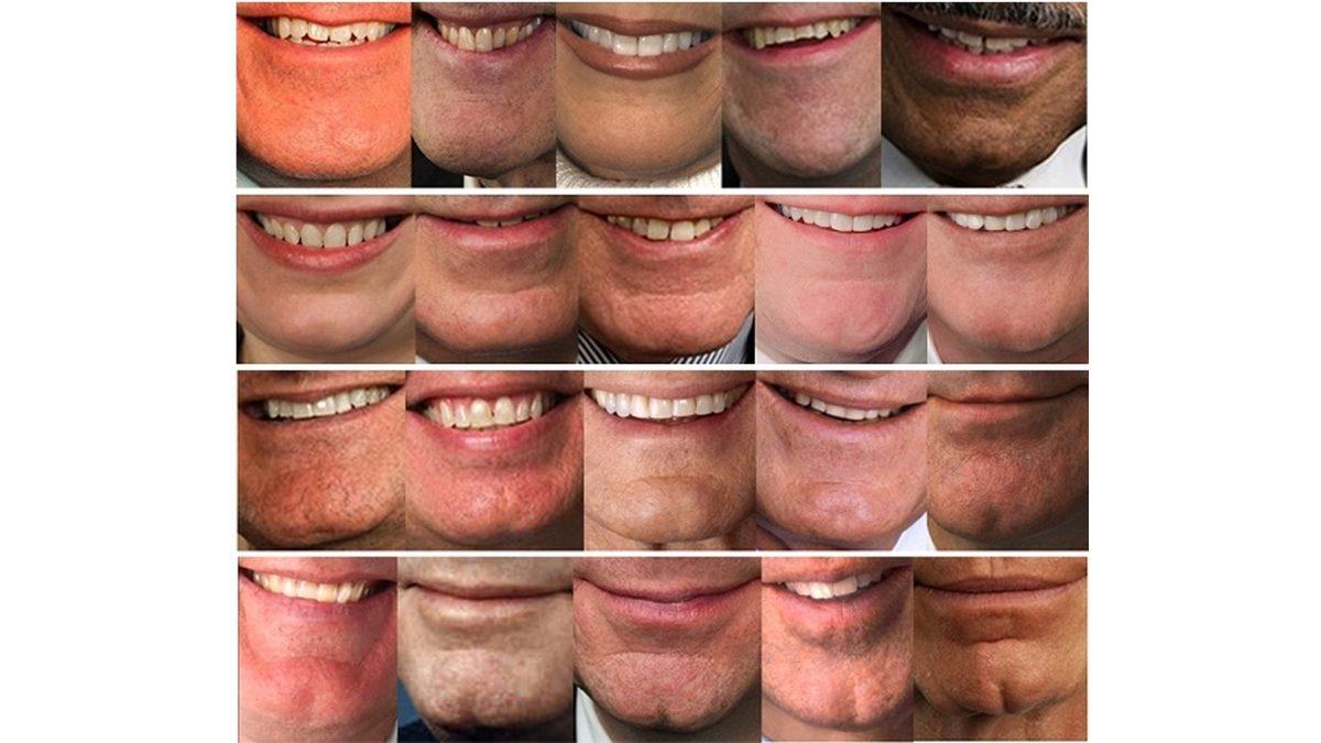 Çene Ucunun, Koskoca Hayvanlar Aleminde Sadece İnsanlarda Olmasının Sebebi Ne? Cinsel Seçilim Bile Rol Oynuyor Olabilir!