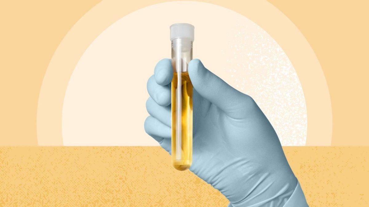 Farklı Renkte Gıdalar Tüketmemize Rağmen Neden İdrarımız İnatla Sarı Akıyor?