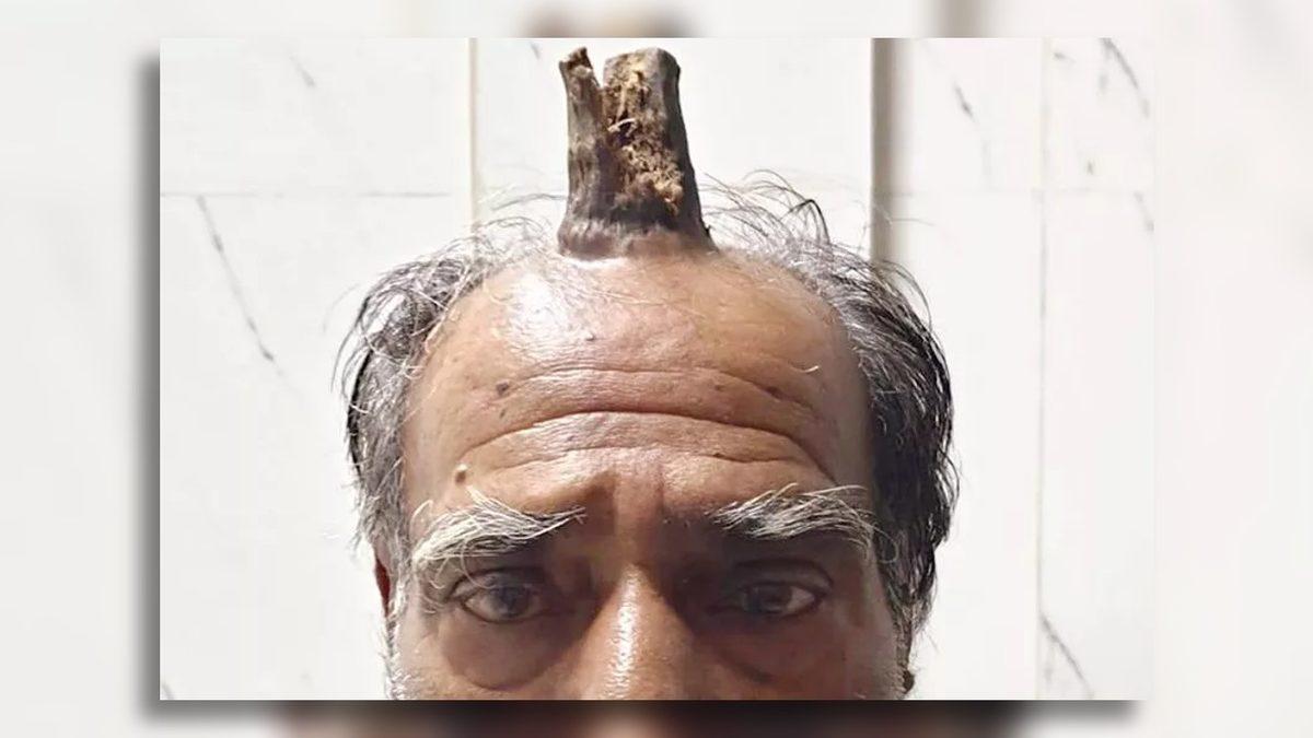 Kafada Âdeta Filizlenerek Çıkan Bu Boynuzun Sebebi Ne? 