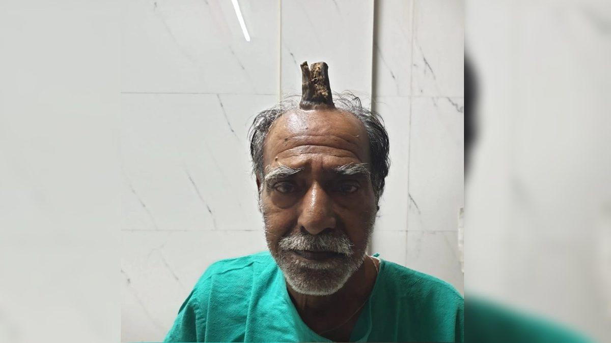 Kafada Âdeta Filizlenerek Çıkan Bu Boynuzun Sebebi Ne? 