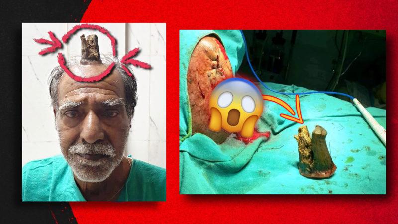 Kafada Âdeta Filizlenerek Çıkan Bu Boynuzun Sebebi Ne? "Benim Başıma Gelmez." Demeyin...