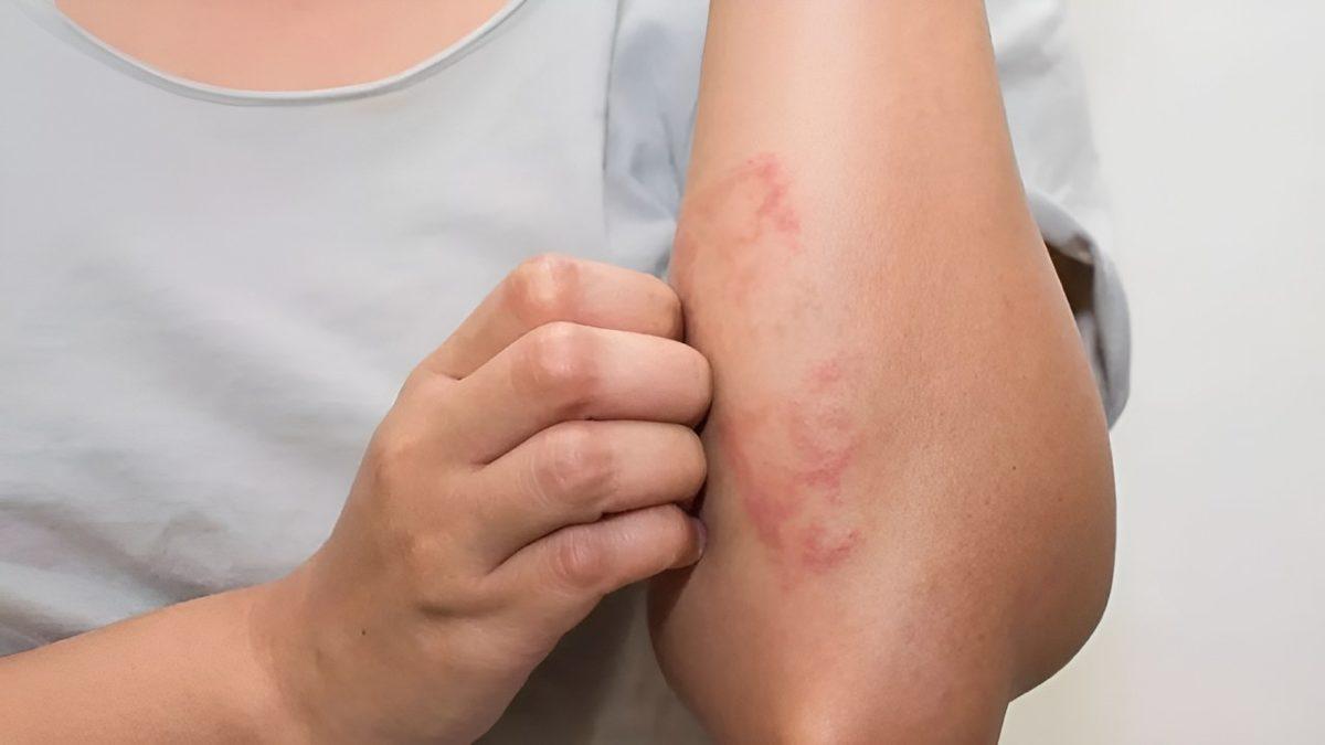 Beynimizin Bile Tanımlayamadığı Gerçek: Kabuk Tutan Yaralar Neden Israrla Kaşınır?