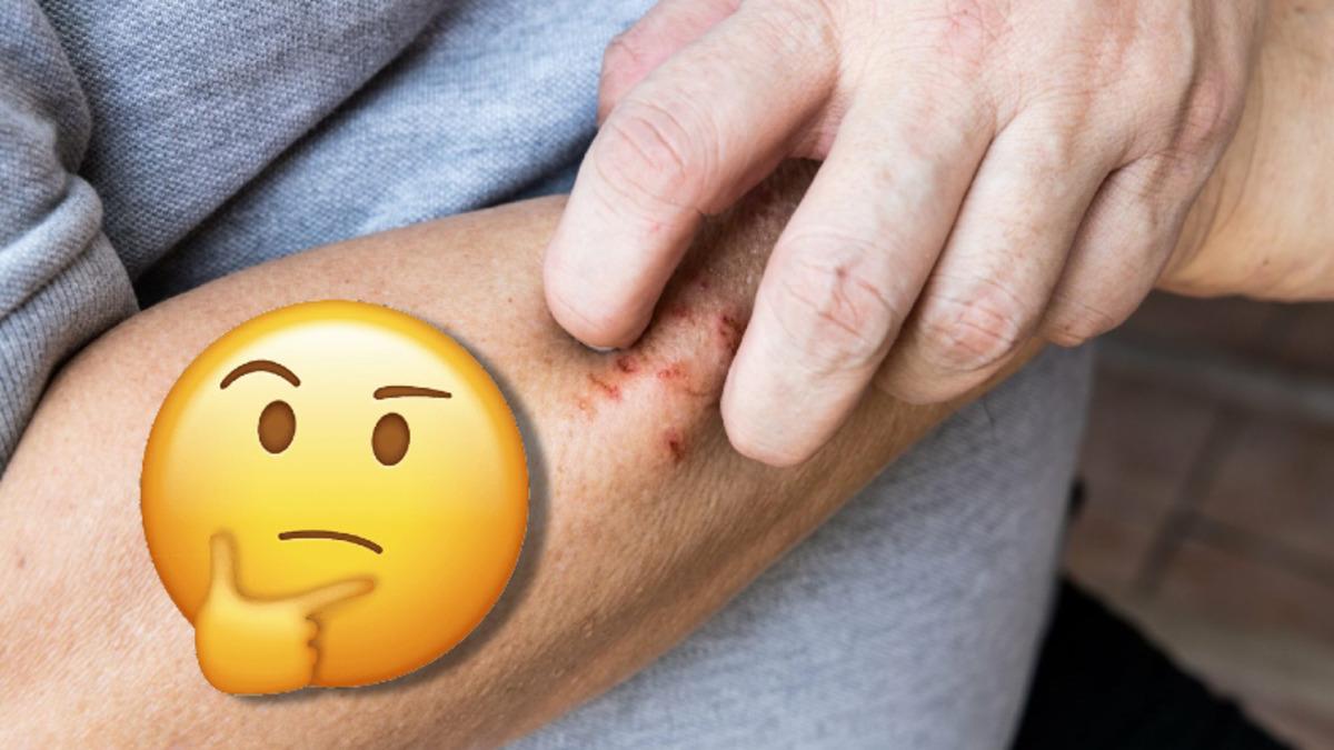 Beynimizin Bile Tanımlayamadığı Gerçek: Kabuk Tutan Yaralar Neden Israrla Kaşınır?