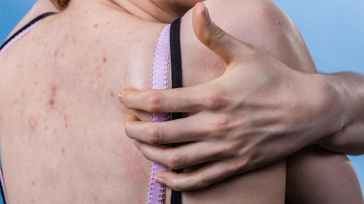 Neden Özellikle ’Sırtımızı’ Kaşımak Bize Bu Kadar Çok Zevk Veriyor ve Rahatlatıyor?