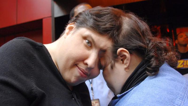 Dünyanın En Yaşlı Yapışık İkizleri Öldü: İşte İlginç Yaşantıları