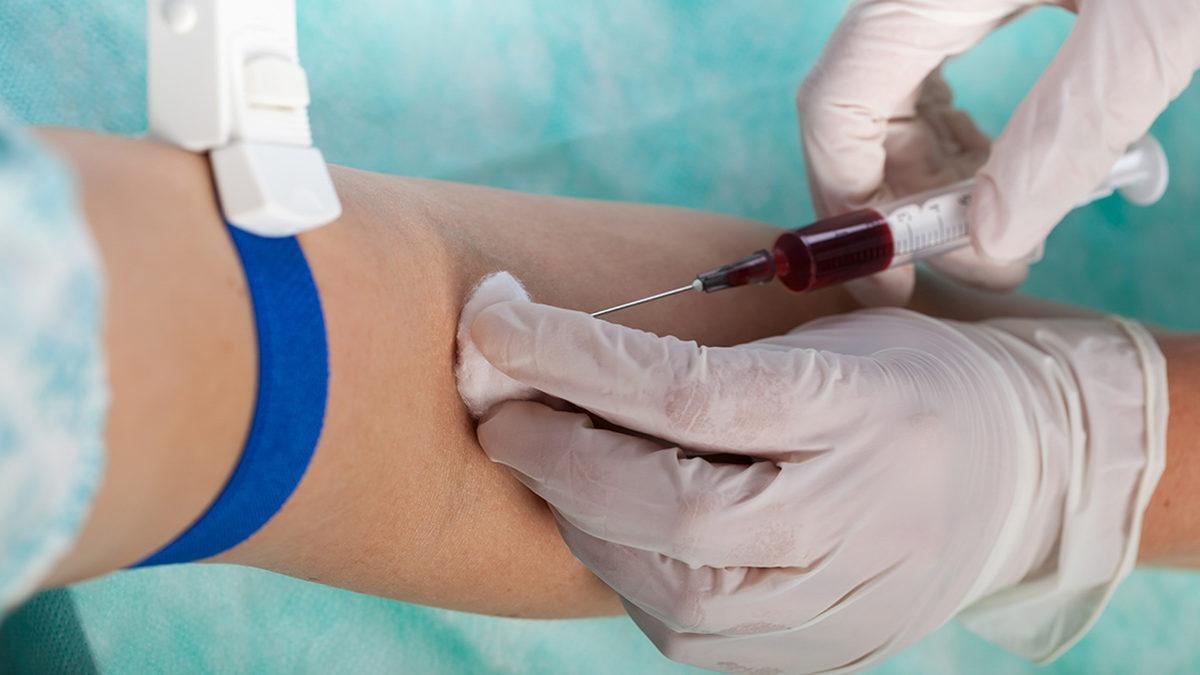 Kan Alırken Neden Atardamar Yerine Toplardamar Tercih Ediliyor? Sebebini Öğrendikten Sonra İğne Korkunuzdan Vazgeçebilirsiniz!