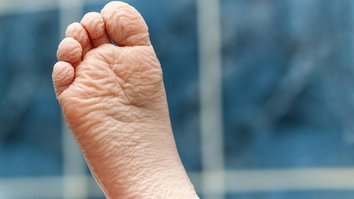 Uzun Süre Suda Kaldığımızda Neden Sadece El ve Ayaklarımız Buruşur?