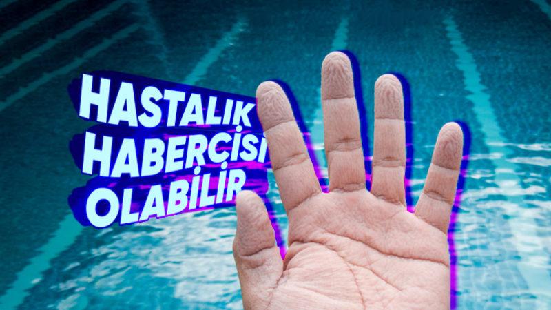 Uzun Süre Suda Kaldığımızda Neden Sadece El ve Ayaklarımız Buruşur?