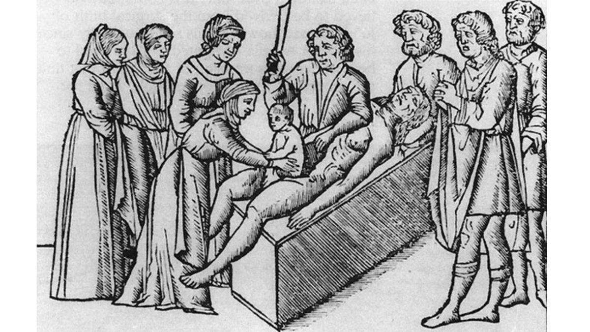 Artık Testere Kullanırken İki Kere Düşüneceksiniz: Zamanında Kadınların Doğumunu ’Kolaylaştırmak’ İçin İcat Edilmiş!