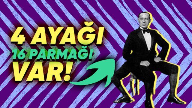 Üç Bacak ve İki Penisle Doğan Frank Lentini’nin Pek Çok Kişiye İlham Olabilecek Hayat Öyküsü