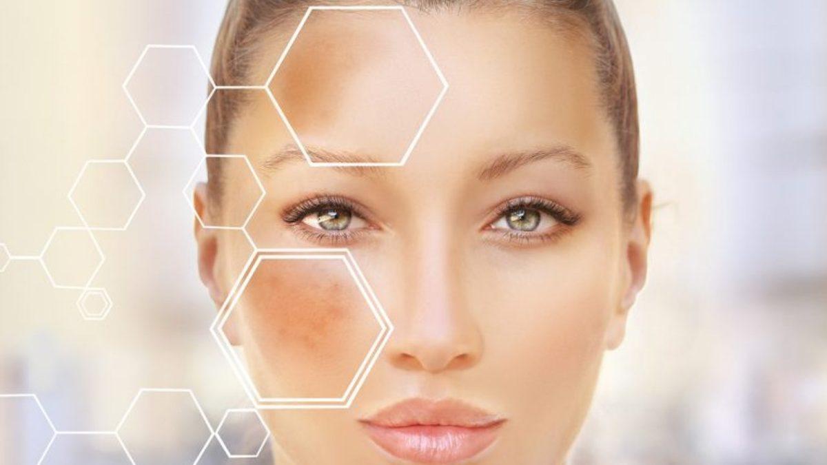 Esmer İnsanlar Nasıl oluyor da Beyaz Tenli İnsanlara Göre İki Kat Daha Fazla Radyasyon Yayabiliyor?