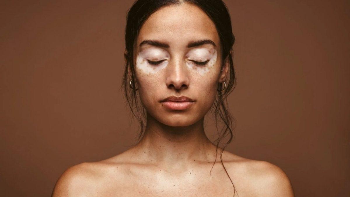 Esmer İnsanlar Nasıl oluyor da Beyaz Tenli İnsanlara Göre İki Kat Daha Fazla Radyasyon Yayabiliyor?