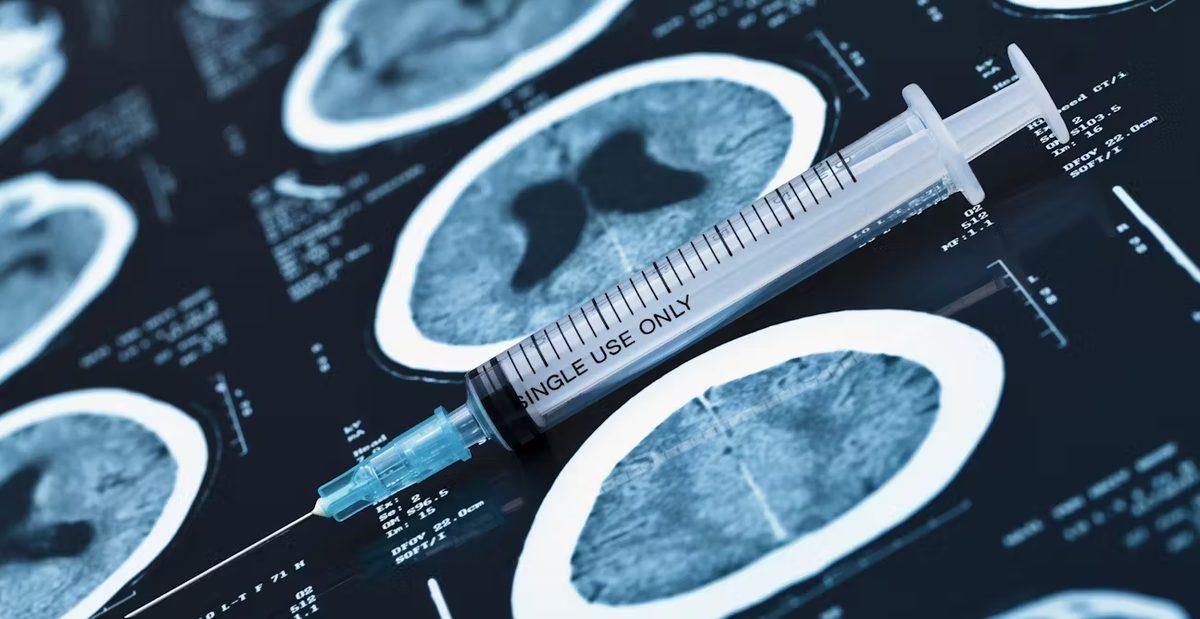 Beyin Tümörüne Karşı Kişiselleştirilmiş Aşı Geliştirildi: İlk İnsanlı Denemeler Başarılı Oldu