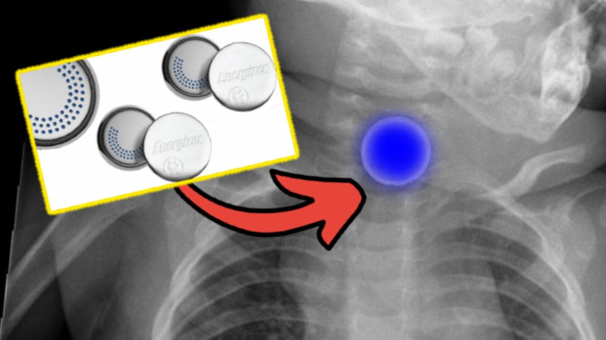 Energizer’dan Çocukların Pil Yutmasını Engelleyecek Teknoloji: Anne Babalar Anında Uyarılacak