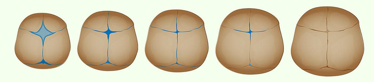 Bebeklerde Neden Yetişkinlere Göre Daha Fazla Kemik Var?