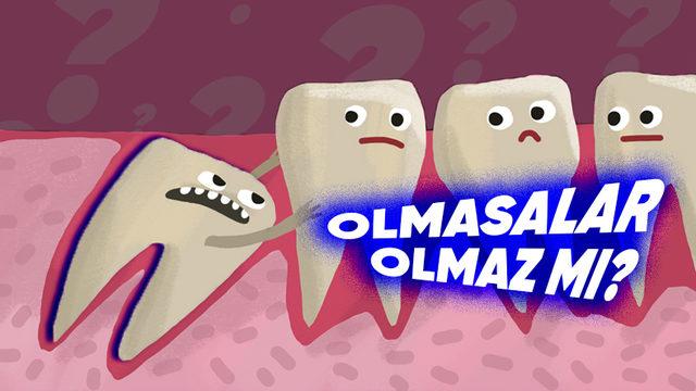 Neredeyse Hiçbir İşlevi Olmadığı Gibi Ağrısıyla da Başımıza Dert Açan Yirmilik Dişlerimiz Neden Var?