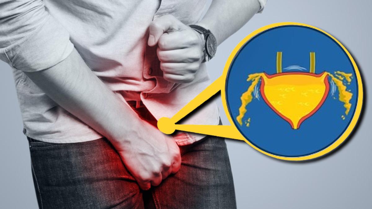 İdrarınızı Çok Uzun Süre Tuttuğunuzda Başınıza Gelecekleri Öğrenince Anında Tuvalete Koşacaksınız!