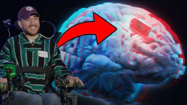 Neuralink, İlk Kez Bir İnsanın Beynine Çip Taktıktan Sonra Nasıl Sorunlar Yaşandığını Açıkladı