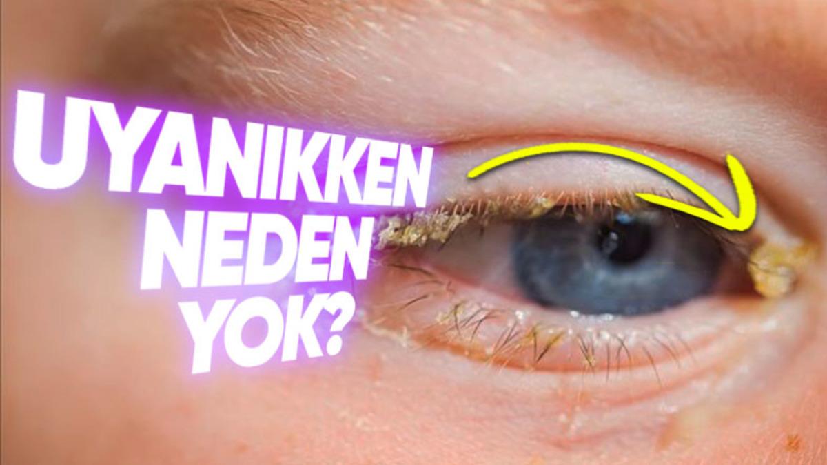 Gece Ne Oluyor da Sabah Uyandığımızda Gözümüzde Çapaklar Oluşuyor?