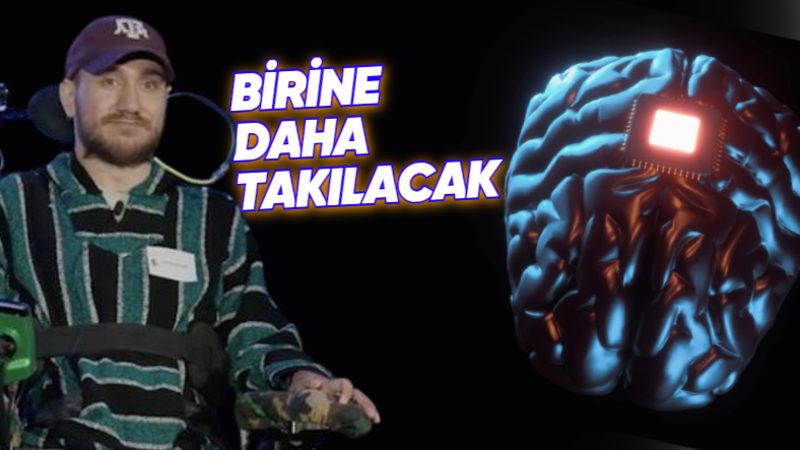 Neuralink, ABD’den Resmen Onay Aldı: Beyin Çipi, Yakında İkinci Hastaya Yerleştirilecek