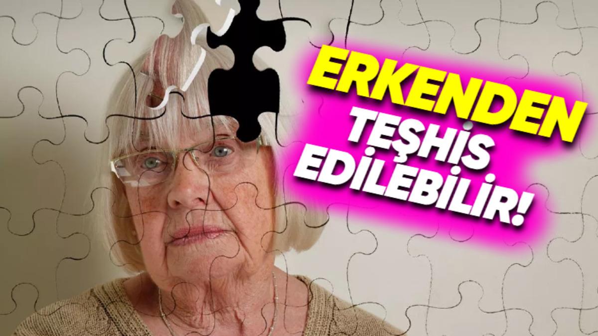 Alzheimer’ın Semptomlar Ortaya Çıkmadan Bile Önce Tespit Edilmesini Sağlayacak Yöntem Keşfedildi