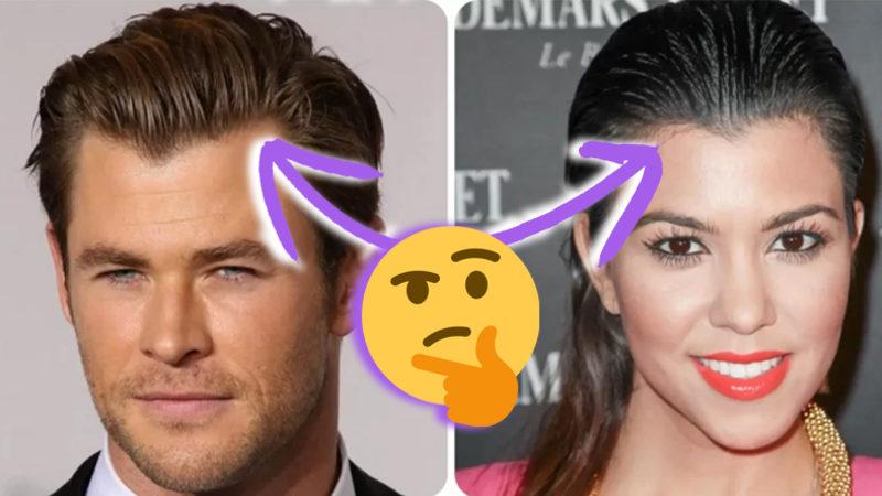 Erkeklerin Saç Çizgisi Neden Bariz Şekilde Kadınlardan Daha Farklı? Kabul Edelim, Kadınlar Daha Şanslı!