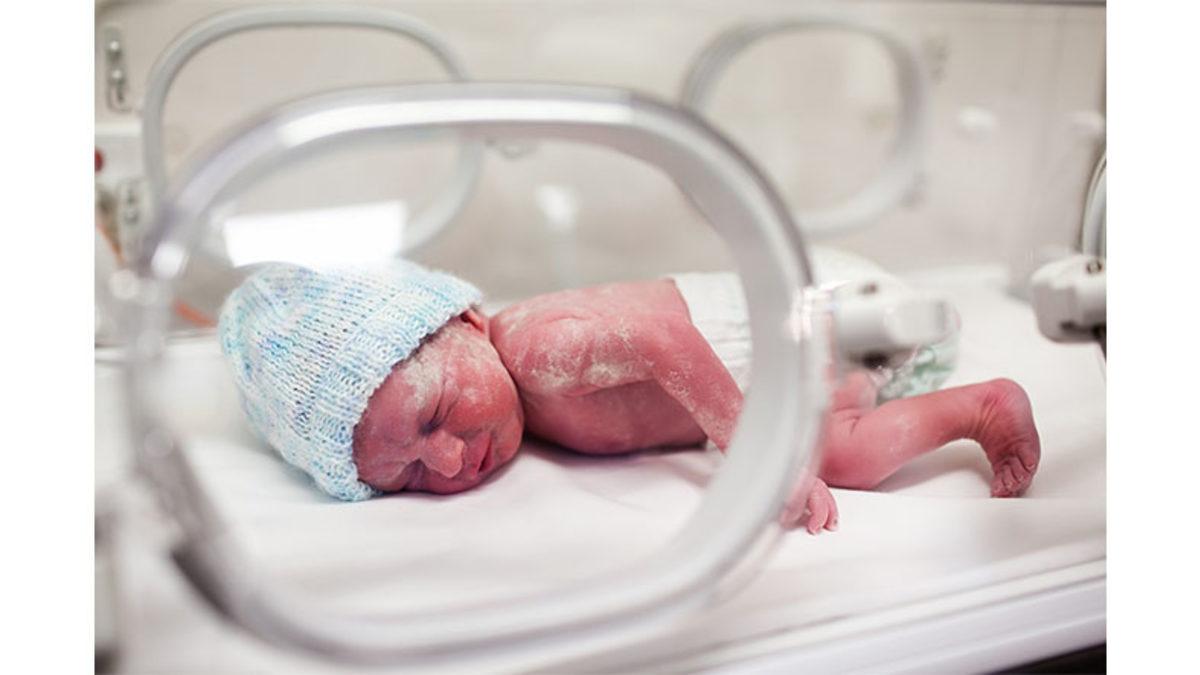 Bebekler Doğduklarında Neden Oyuncak Bebek Gibi Buruş Buruş Görünürler?