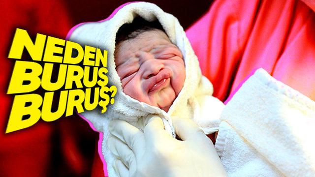 Bebekler Doğduklarında Neden Oyuncak Bebek Gibi Buruş Buruş Görünürler?