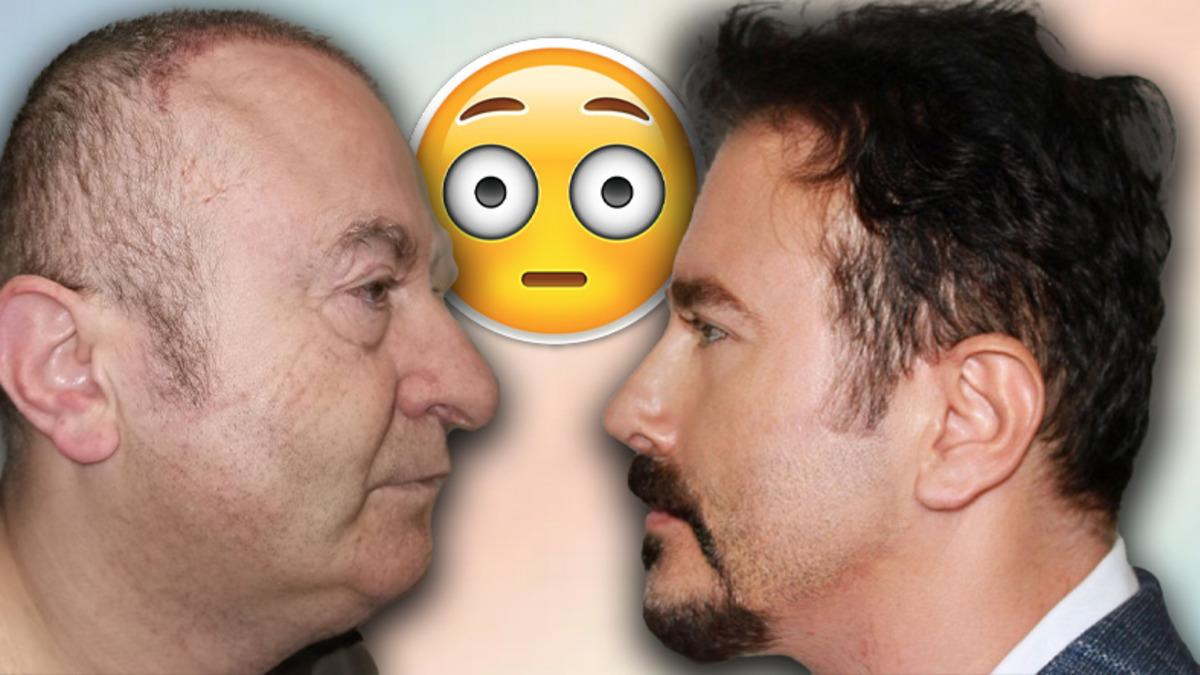 Türkiye’ye Gelip, 7 Estetik Operasyon Sonrası Âdeta 30 Yıl Gençleşen Adam Dünya Çapında Gündem Oldu