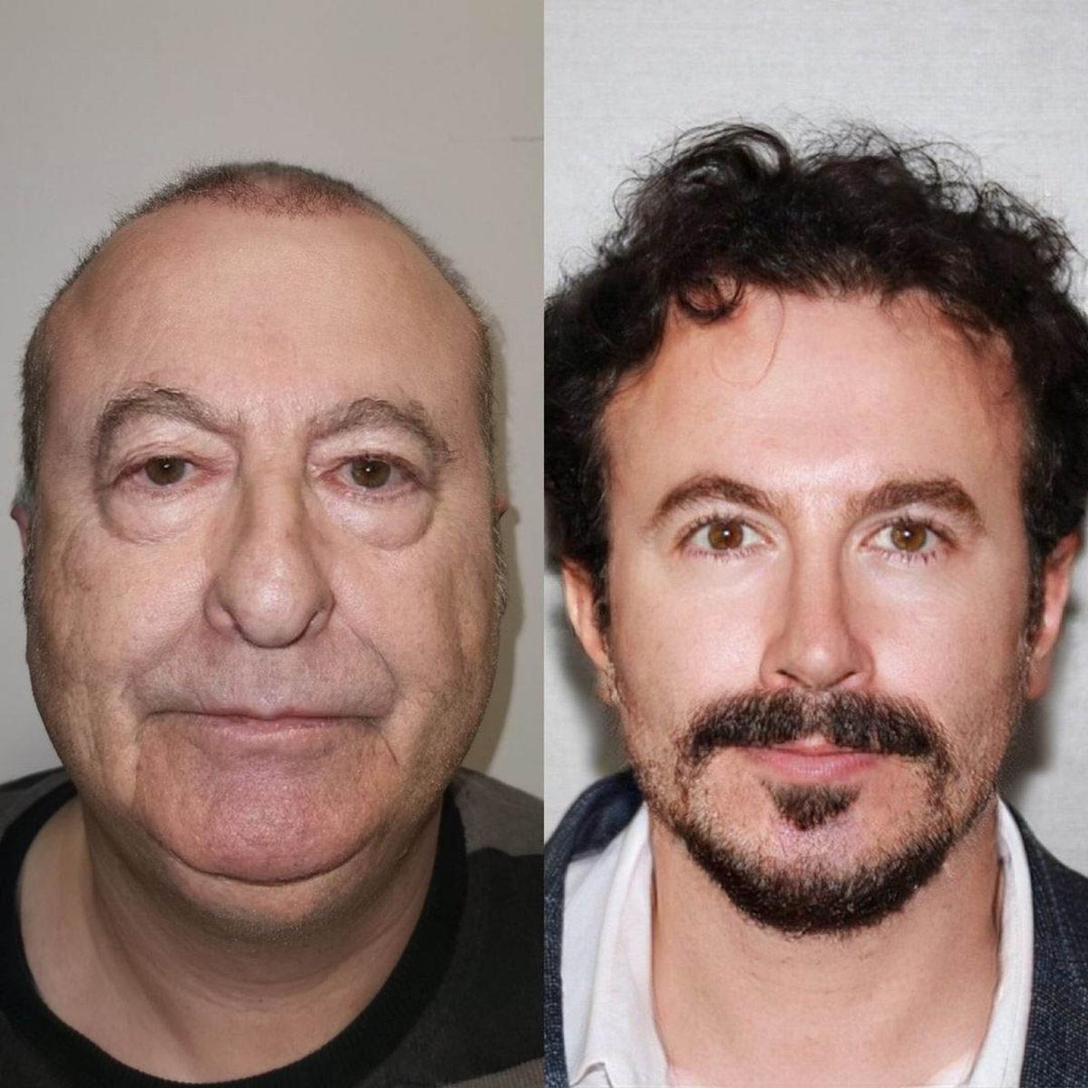 Türkiye’de Geçirdiği Estetik Operasyonla 30 Yıl Gençleşerek Dünyada Gündem Olan Turistin Aslında Türk Olduğu Ortaya Çıktı! Görüntüler Sahteymiş