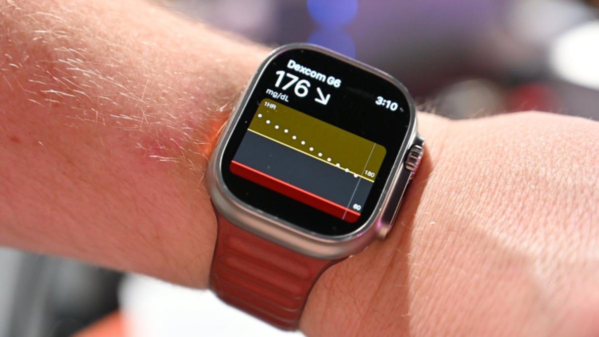 Apple Watch’larla Şeker Takibi Yakında Gelebilir: Dexcom G7 Apple Watch’a Bağlanabilecek