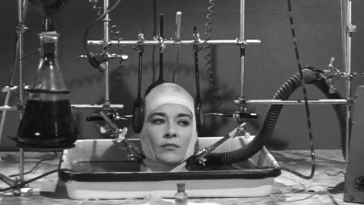 Bir İnsanın Kafasını, Başka Bir İnsanın Vücuduna Nakletmek Mümkün mü?