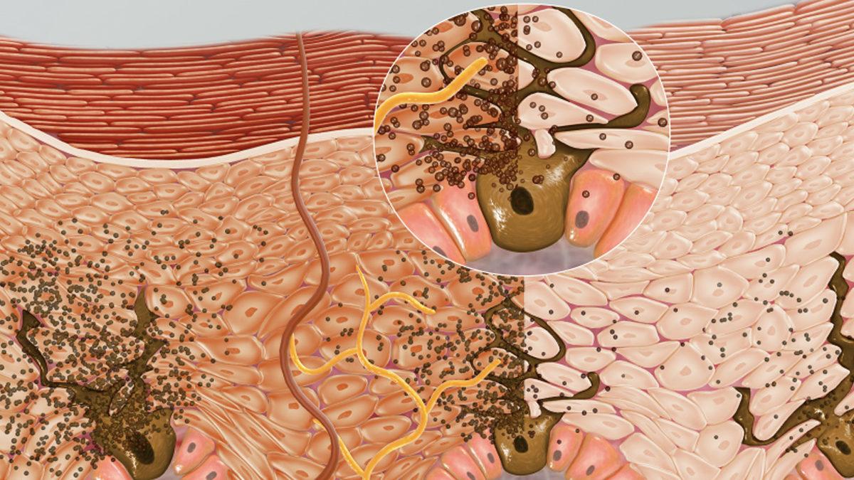 Kıskançlık Sebebi: Neden Bazı İnsanlar Daha Hızlı Bronzlaşıyor?