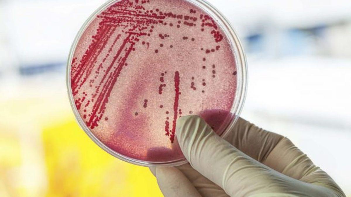 Japonya, Et yiyen Bakteri İstilâsı Altında: Ölüm Riski Çok Yüksek!