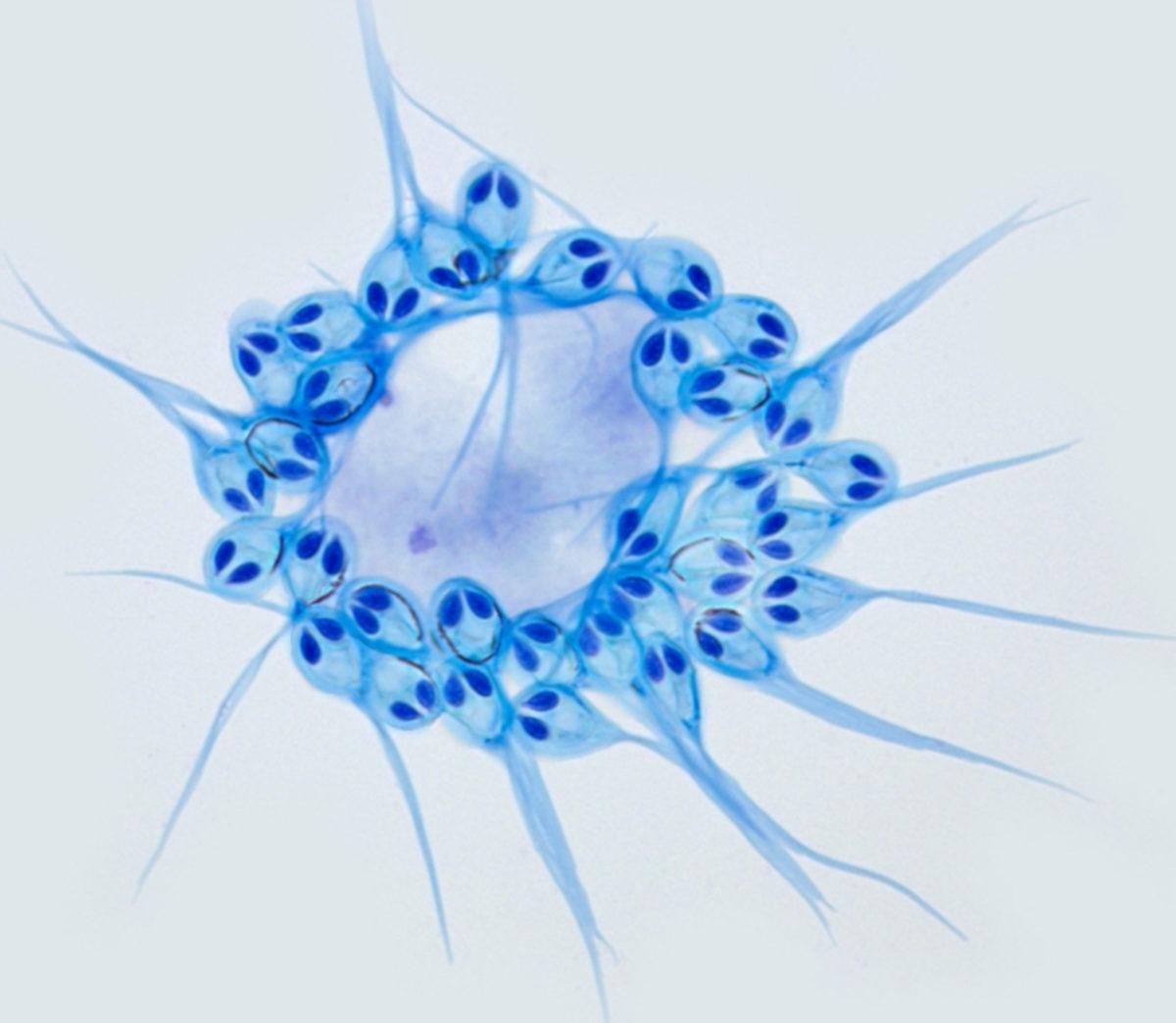 Yaşamak İçin Oksijene İhtiyaç Duymayan İlk Canlı Türü Keşfedildi