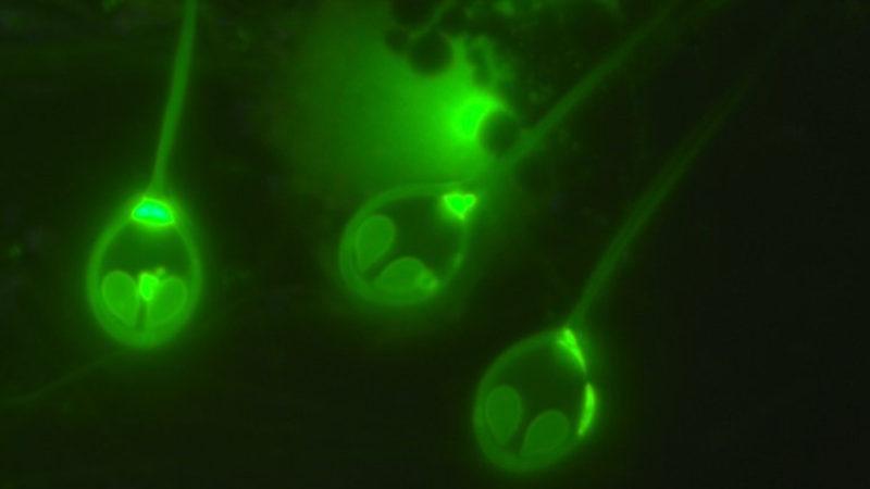 Yaşamak İçin Oksijene İhtiyaç Duymayan İlk Canlı Türü Keşfedildi