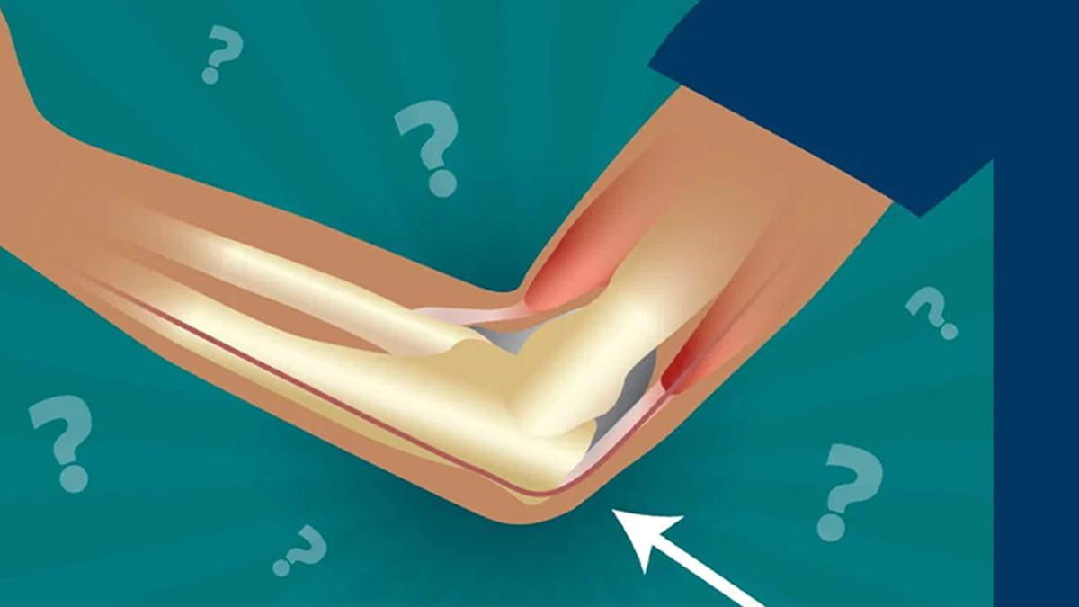 Dirseğimizi Bir Yere Çarptığımızda Neden Elektrik Çarpmış Gibi Hissederiz?