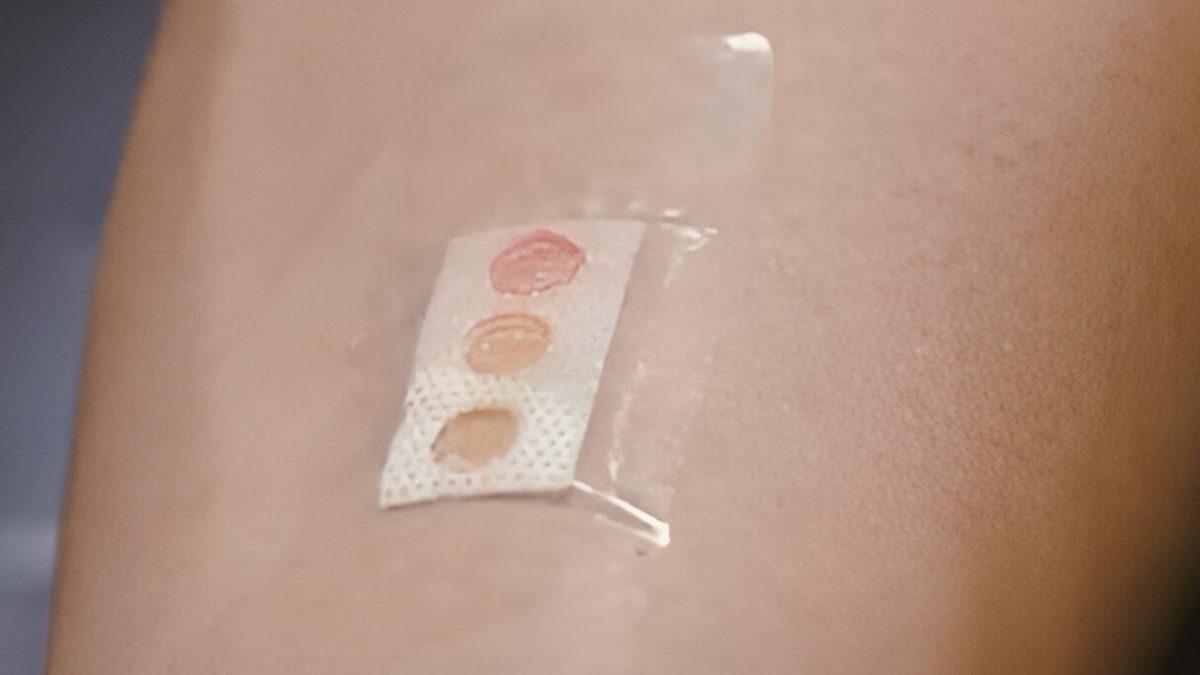 Kandaki Şeker Oranını Ölçebilen 