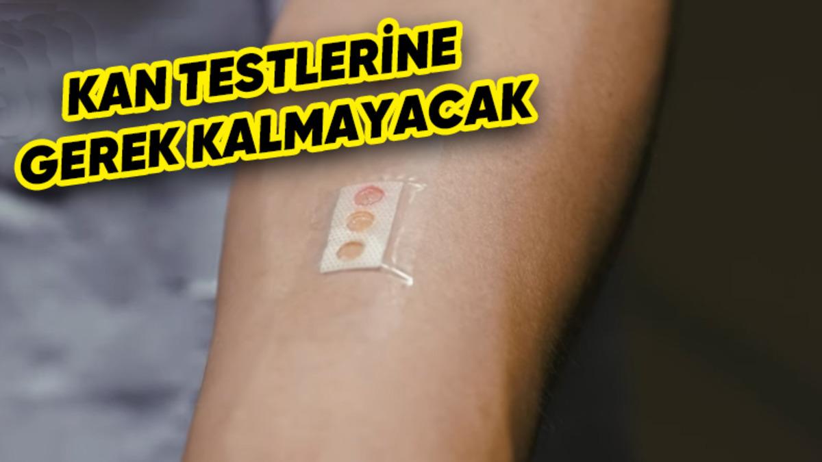 Kandaki Şeker Oranını Ölçebilen "Yara Bandı Benzeri" Cihaz Geliştirildi