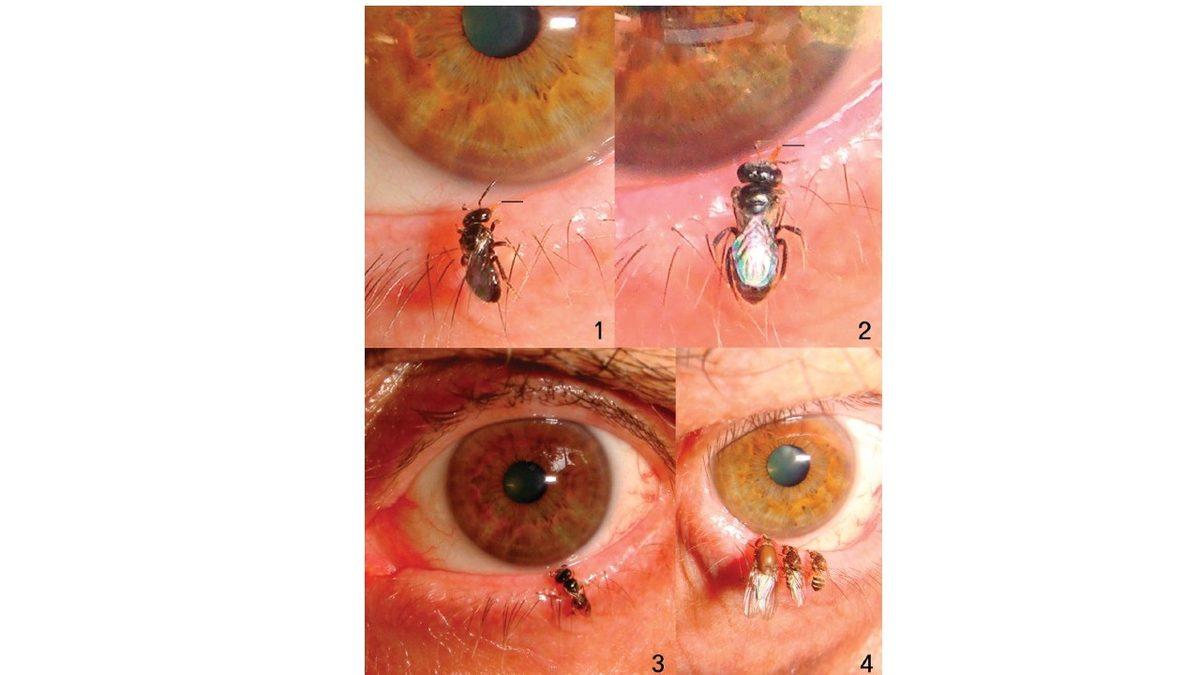 Bilim İnsanları Yaptıkları Bir Çalışmada Arıları Gözlerine Yerleştirerek Ne Amaçlamıştı? Arkasında Rahatsız Edici Bir Gerçek Yatıyor