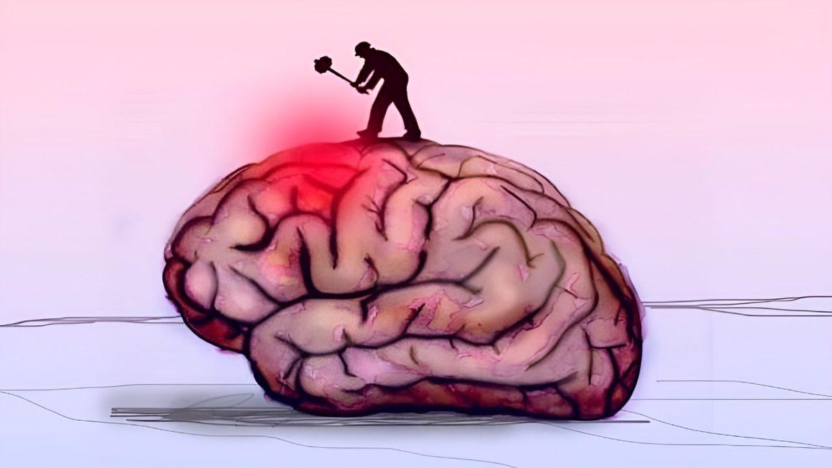 Migren Tuttuğunda Geçmek Bilmeyen O Acının Kaynağını Açıklıyoruz: Beynimizi Nasıl Etkiliyor?