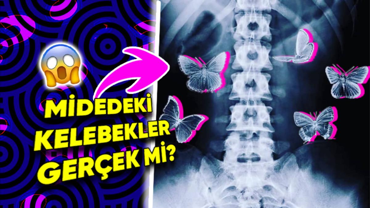 Sıkça Kullandığımız "Birinden Elektrik Almak" ya da “Midemde Kelebekler Uçuşuyor” Tabirleri Fizyolojik Açıdan Gerçek Olabilir mi?