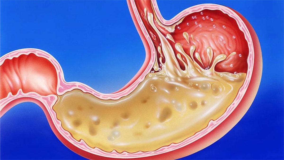 Mide Asidi Midemizdeki Her Şeyi Eritirken Nasıl Oluyor da Midemize Zarar Vermiyor?