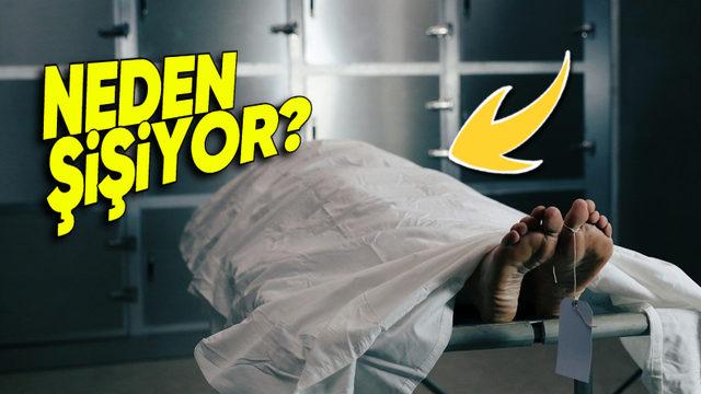 İnsan Vücudu Öldükten Sonra Neden Balon Gibi Şişiyor? Bazen “Güm” Diye Patlayabiliyormuş!