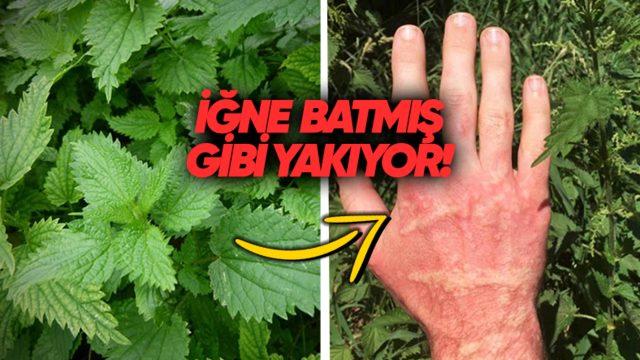 Isırgan Otu Neden Cildimizi Sanki İğne Batmışçasına Yakar?